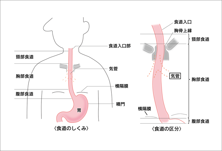 食道がんとは